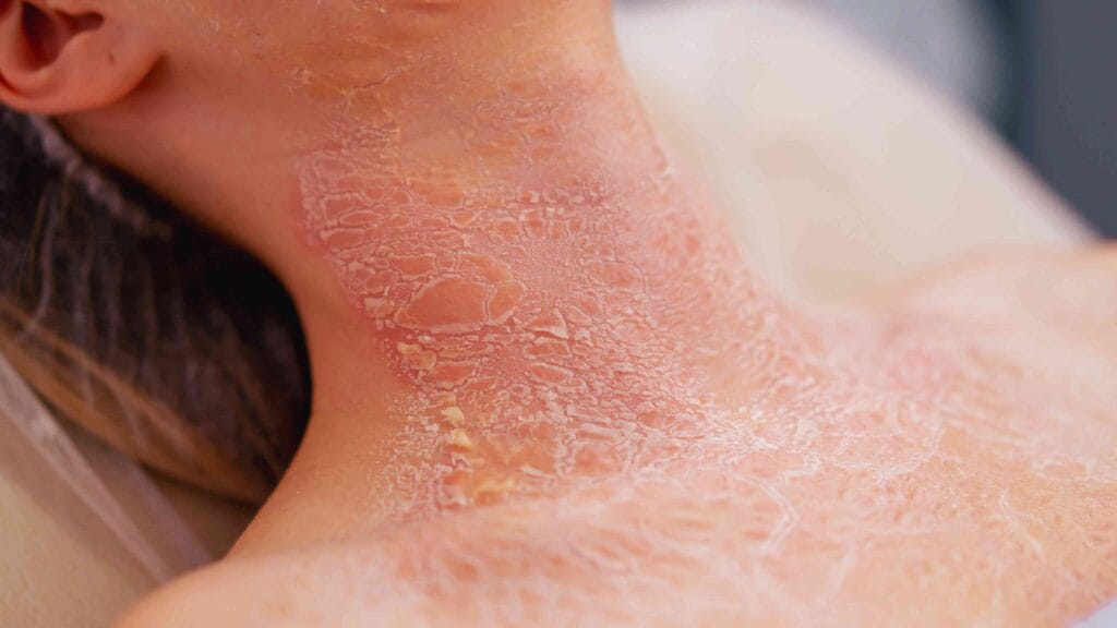 best body moisturizer for dry skin best body moisturizer for dry skin