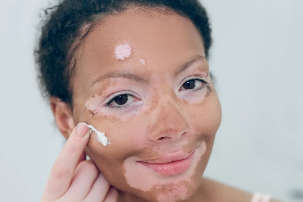 Anti Inflammatory Skin care